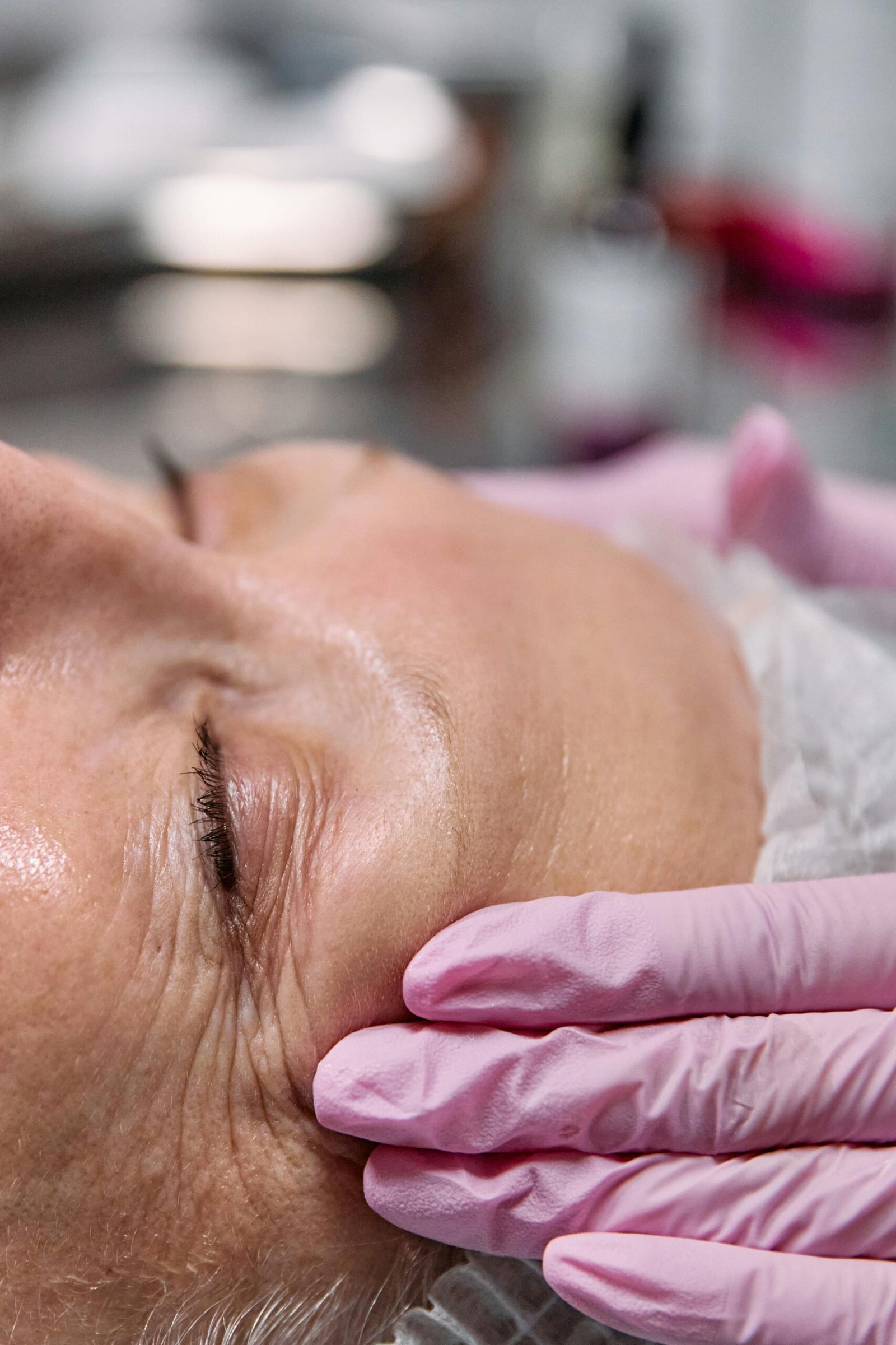 Quais são os sinais de que você precisa de rejuvenescimento facial?